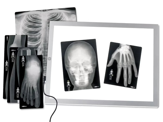 Human X-Rays - Set of 18 - US 6325