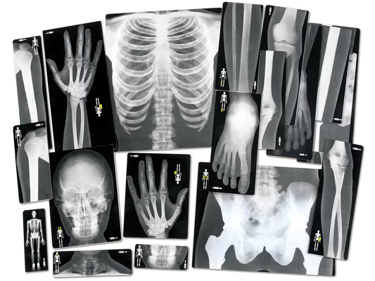 Human X-Rays - Set of 18 - US 6325